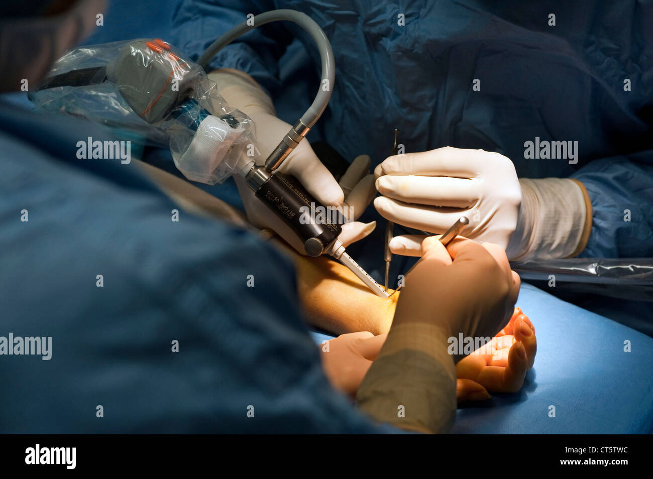 Carpal Tunnel Surgery High Resolution Stock Photography and Images - Alamy