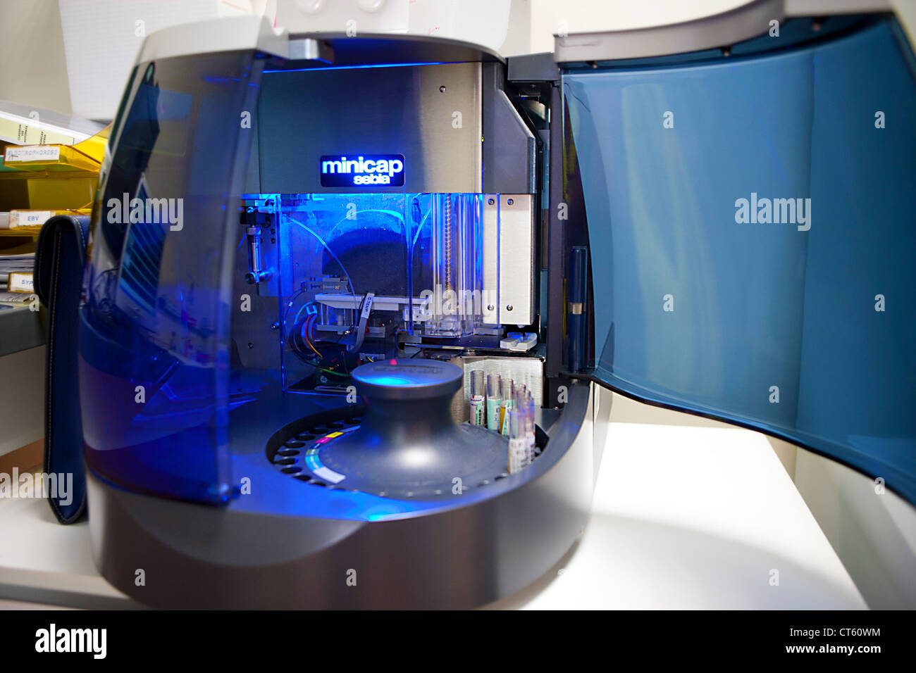 PROTEIN ELECTROPHORESIS Stock Photo 49304912 Alamy