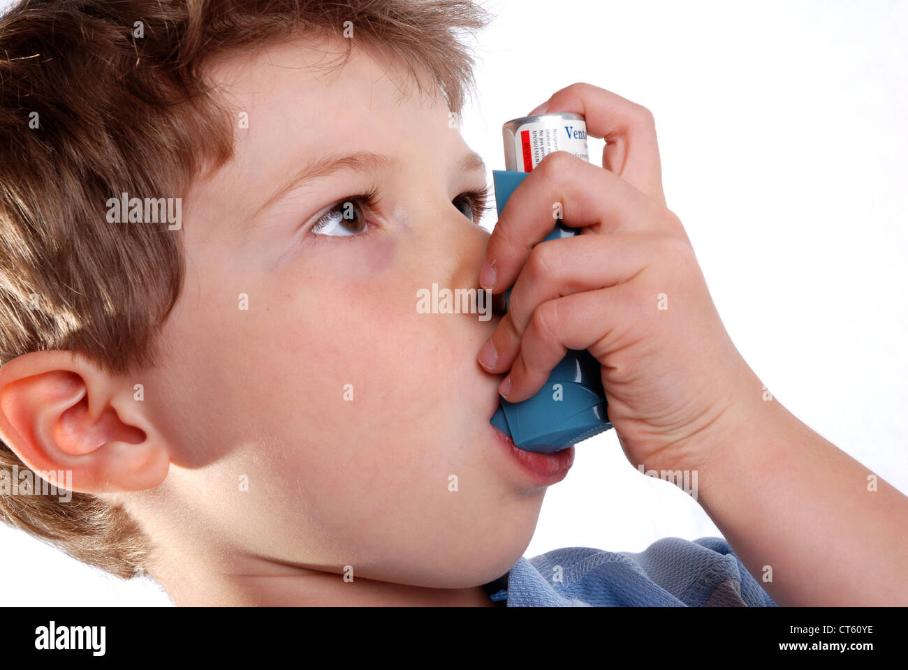 Астма 100. Бронхиальная астма. Мальчик с астмой. Бронхиальная астма у детей специалисты. Бронхиальная астма у детей стики.