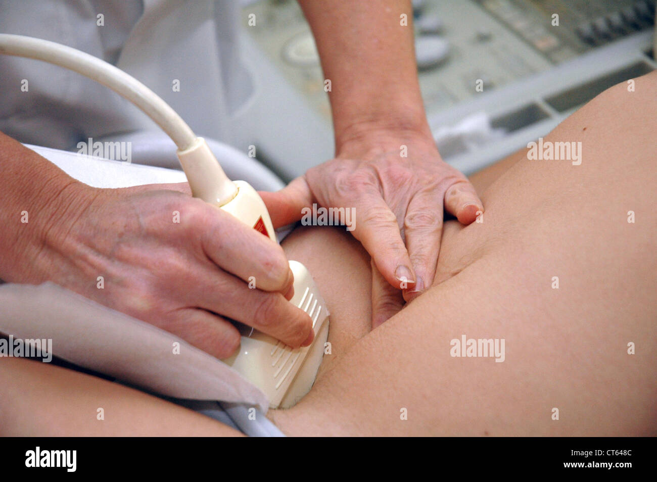 Can suggest internal vulva examination commit Internal vulva examination interesting