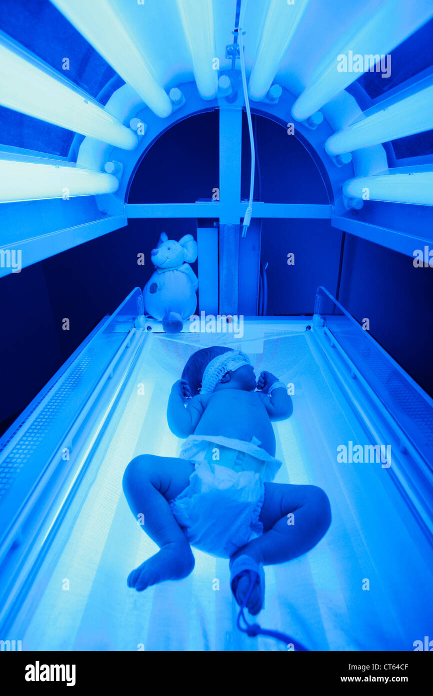 NEONATAL JAUNDICE PHOTOTHERAPY Stock Photo Alamy   Neonatal Jaundice Phototherapy CT64CF 