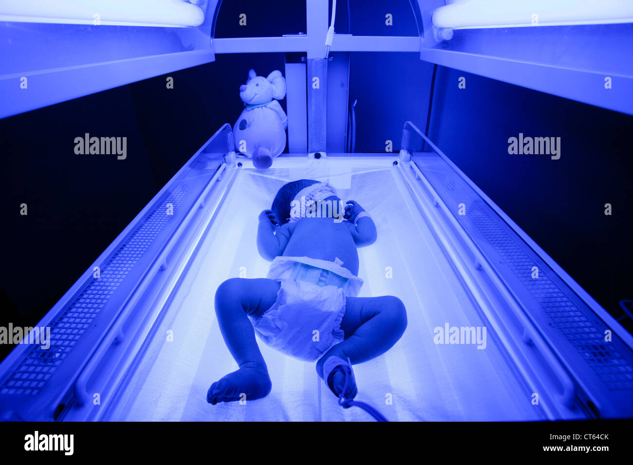 Curing Jaundice With Sunlight at Edward Cochran blog