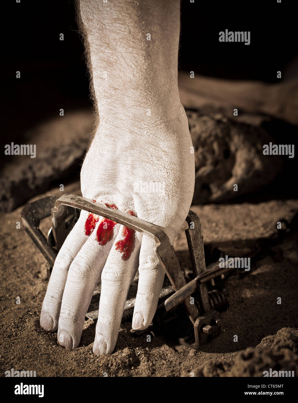 Pale hand caught in a leg hold trap with blood showing. (concept shot) Stock Photo