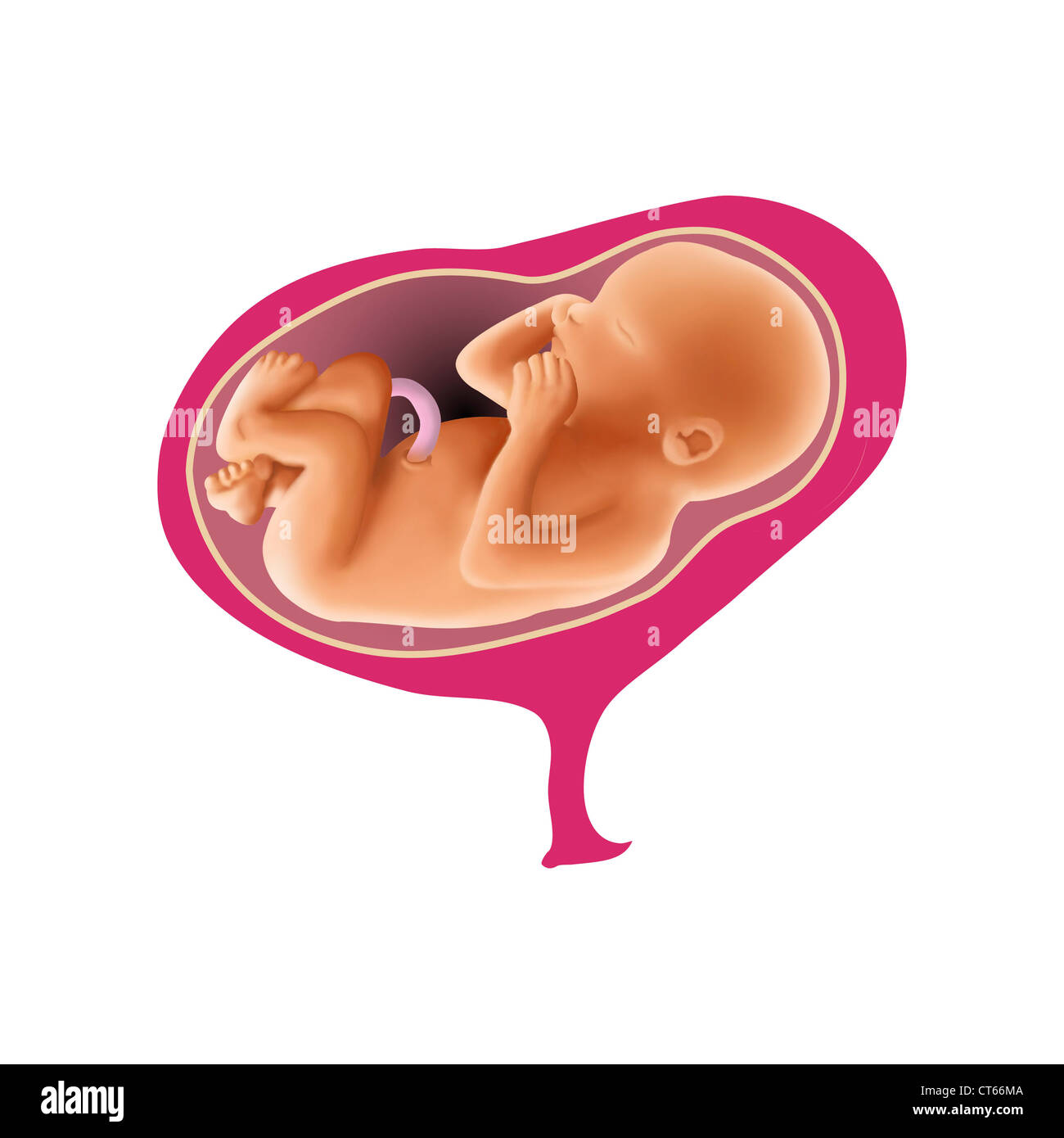 FETAL SHOULDER PRESENTATION Stock Photo