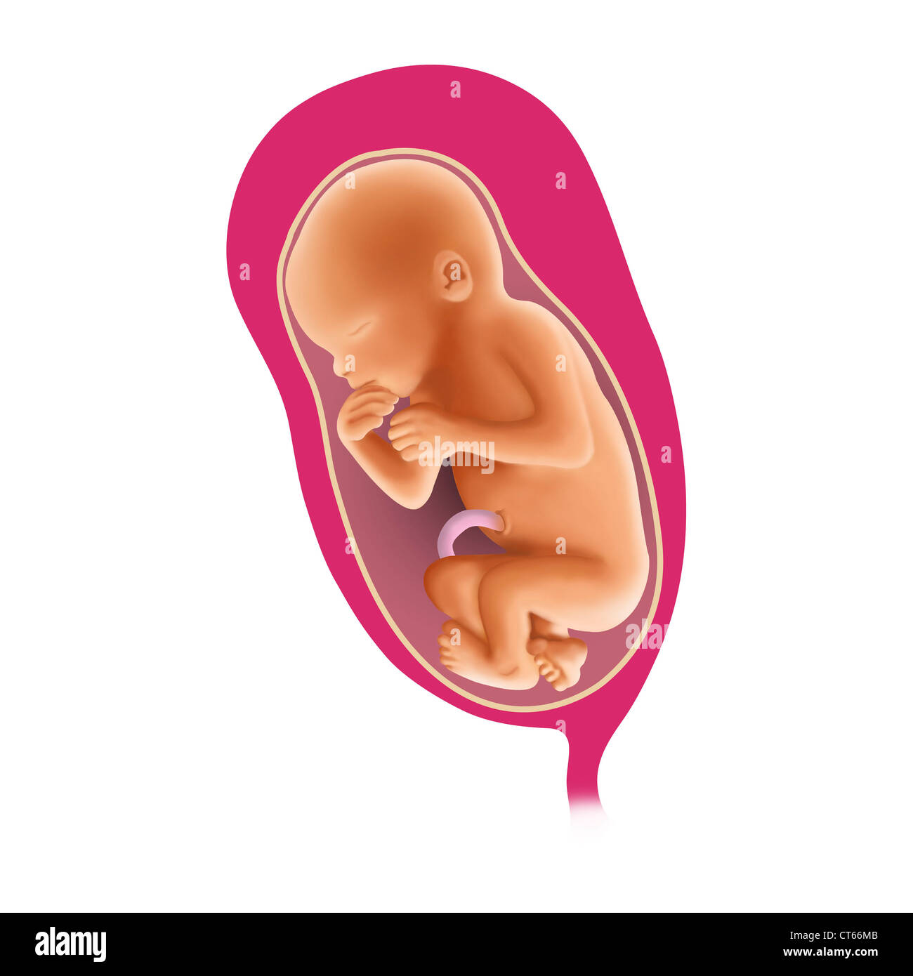 FETAL BREECH PRESENTATION Stock Photo