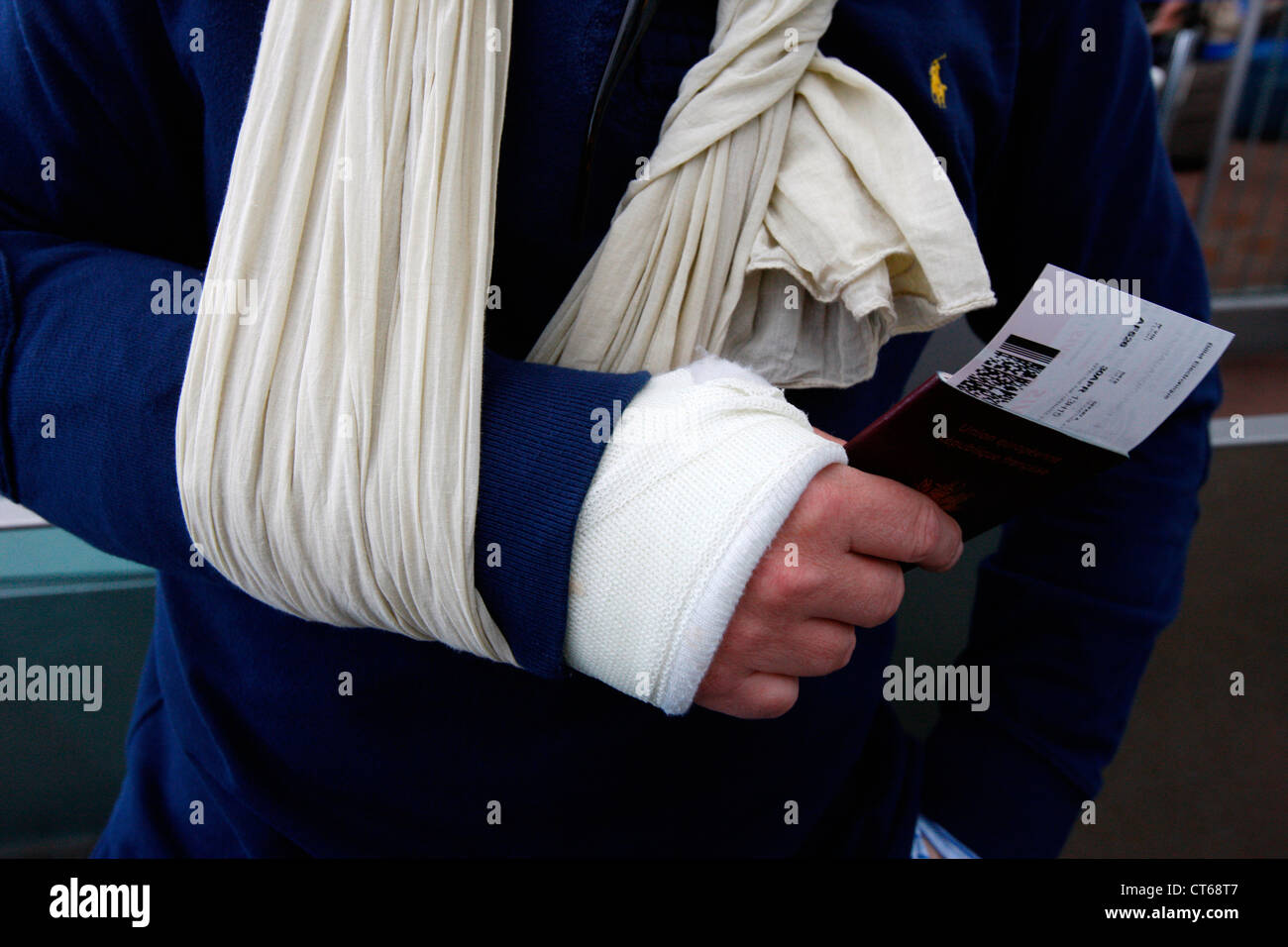 Both arms casts hires stock photography and images Alamy