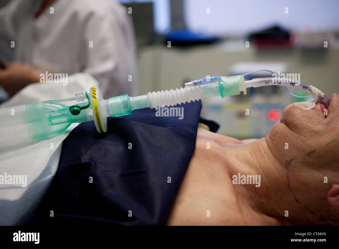 GENERAL ANESTHESIA Stock Photo