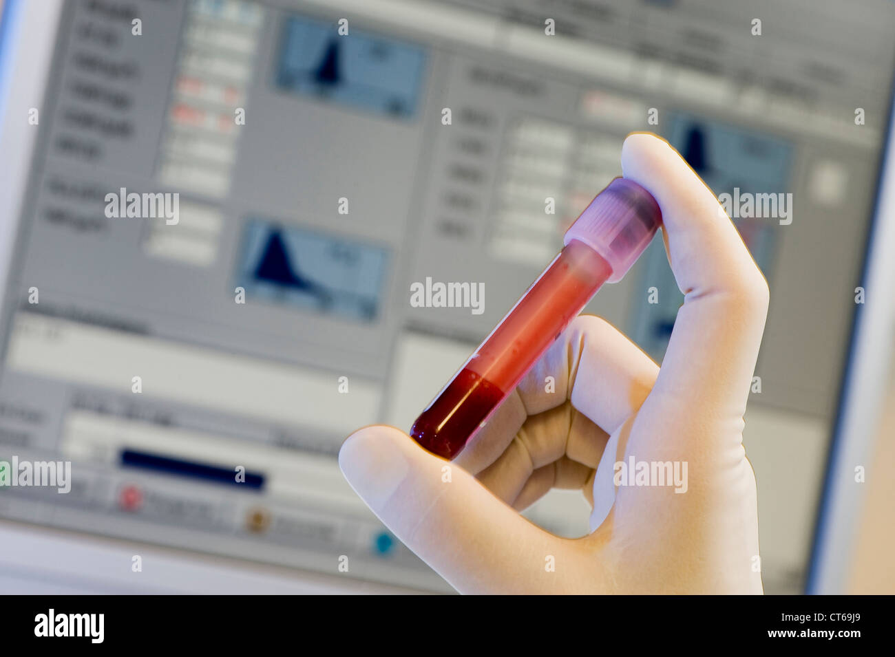 CORD BLOOD ANALYSIS Stock Photo Alamy