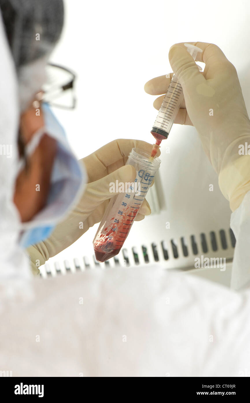 CORD BLOOD ANALYSIS Stock Photo