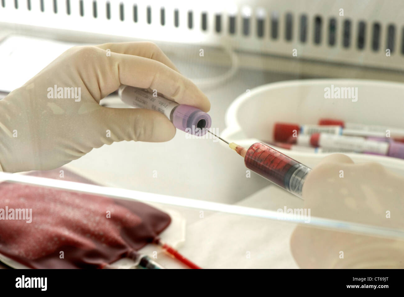 CORD BLOOD ANALYSIS Stock Photo Alamy