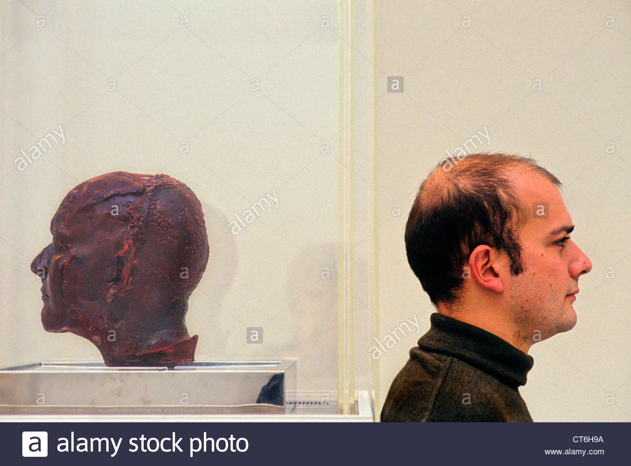 Artist Marc Quinn photographed in 1991 with his "Blood Head Stock Photo 49317782 Alamy
