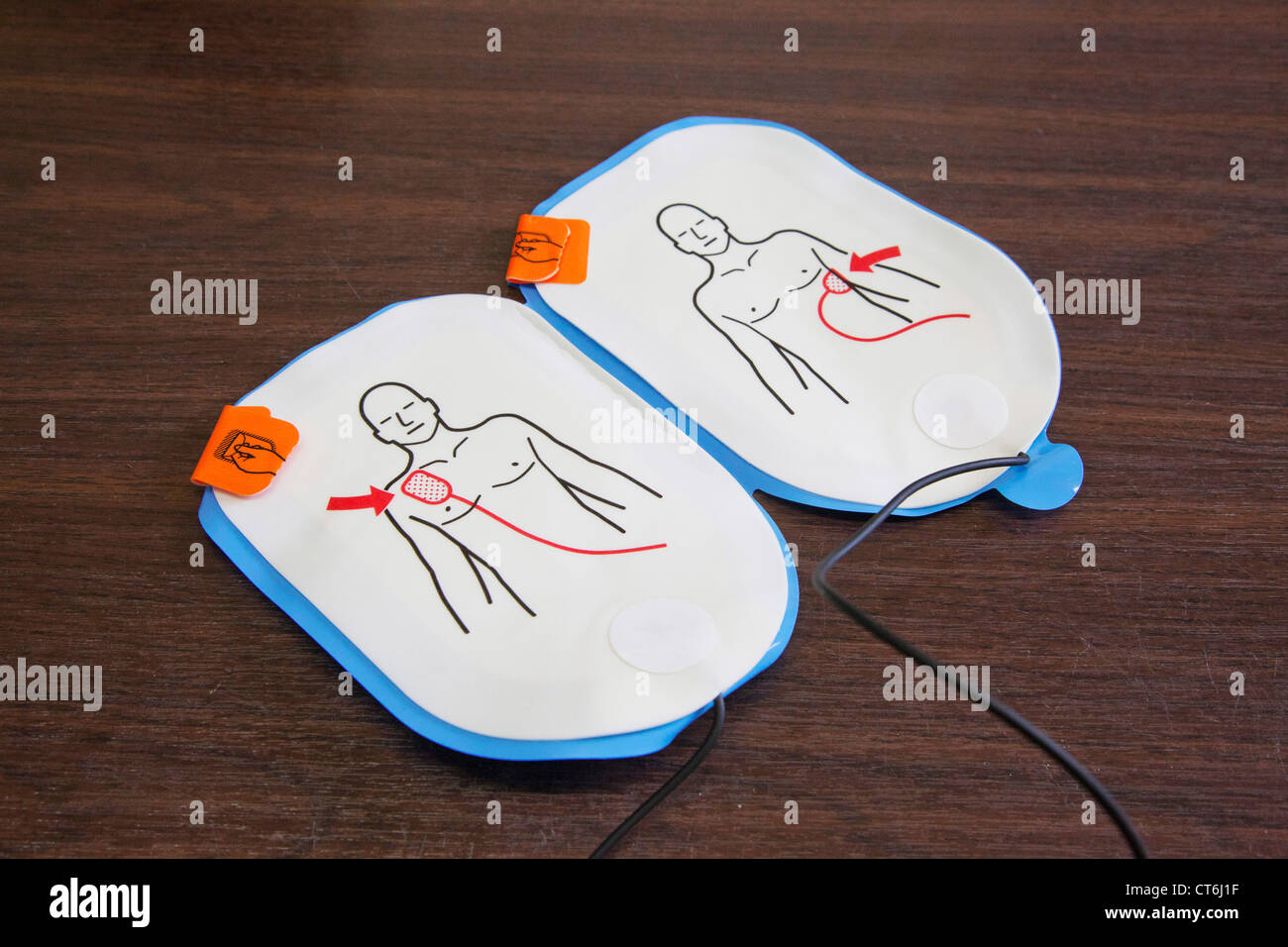 AUTOMATED EXTERNAL DEFIBRILLATOR Stock Photo
