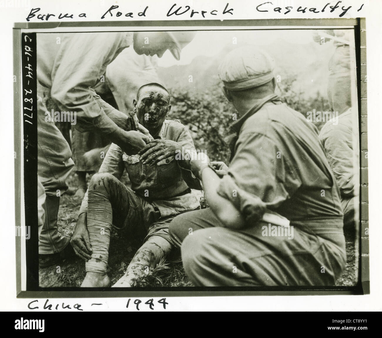 Burma road wreck casualty China 1944 bloodied face accident WWII world war two CBI theatre theater China India Stock Photo