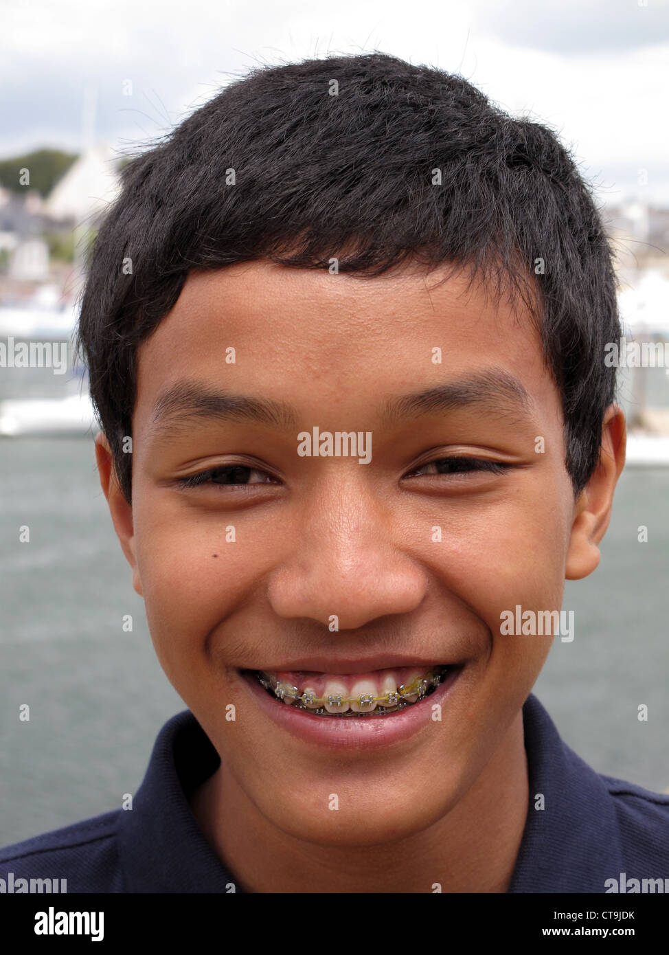Boy with orthodontics braces hires stock photography and images Alamy