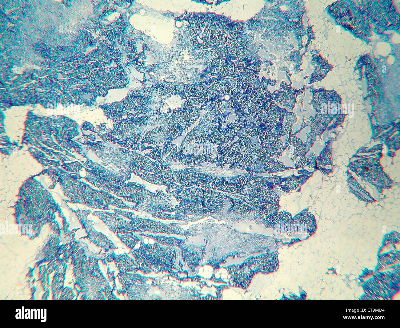 Calf thymus in a 25fold magnification Stock Photo Alamy