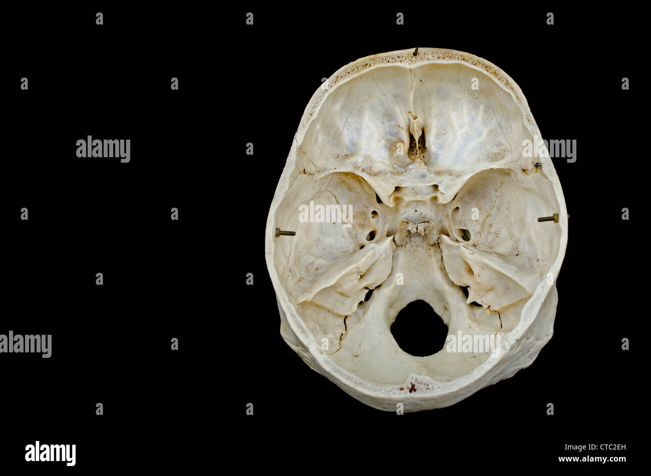 Real human bone - cranial cavity of the skull from the above Stock