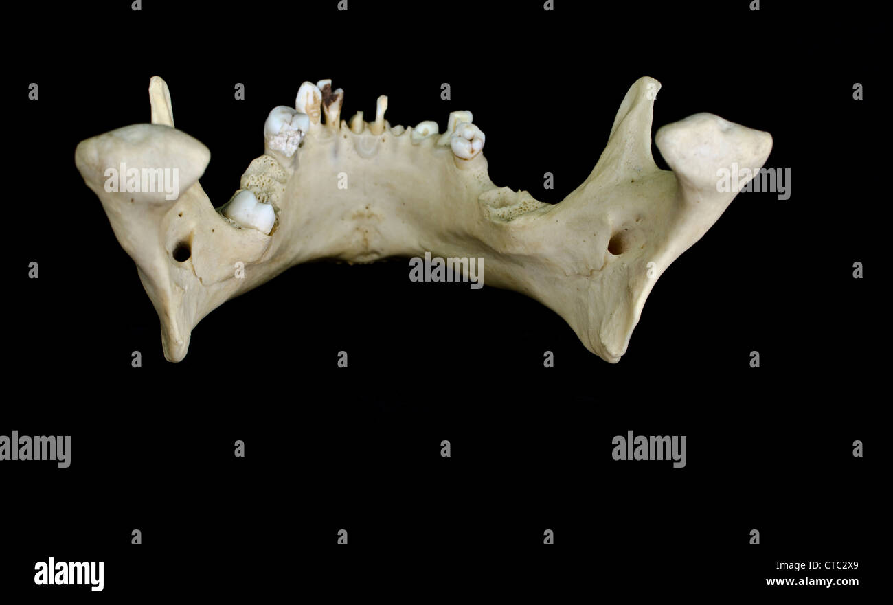 Human Jaw Bone High Resolution Stock Photography and Images - Alamy
