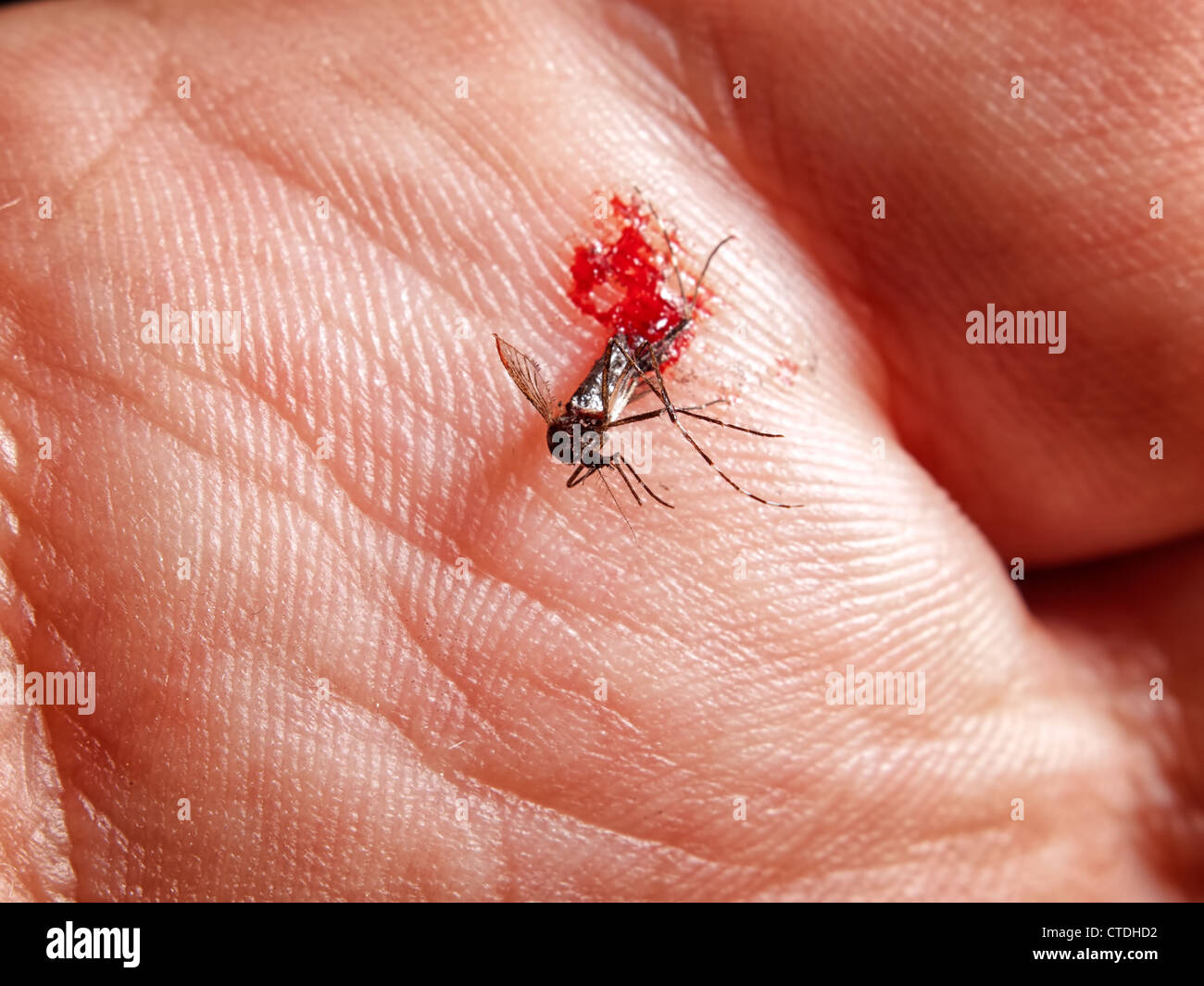 macro-view-of-a-smashed-mosquito-full-of-blood-on-a-palm-CTDHD2.jpg