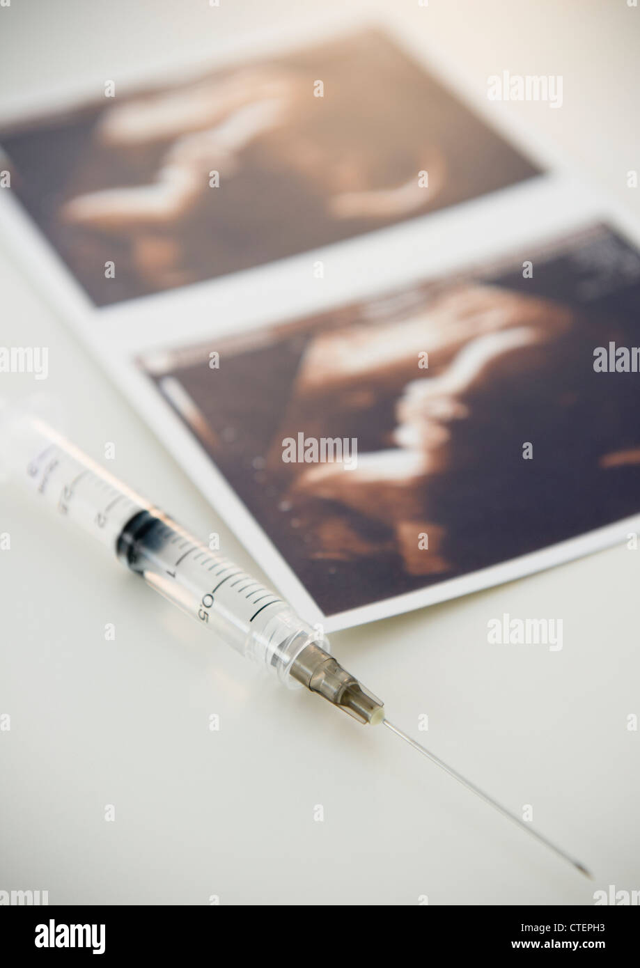 Sonogram and syringe Stock Photo - Alamy