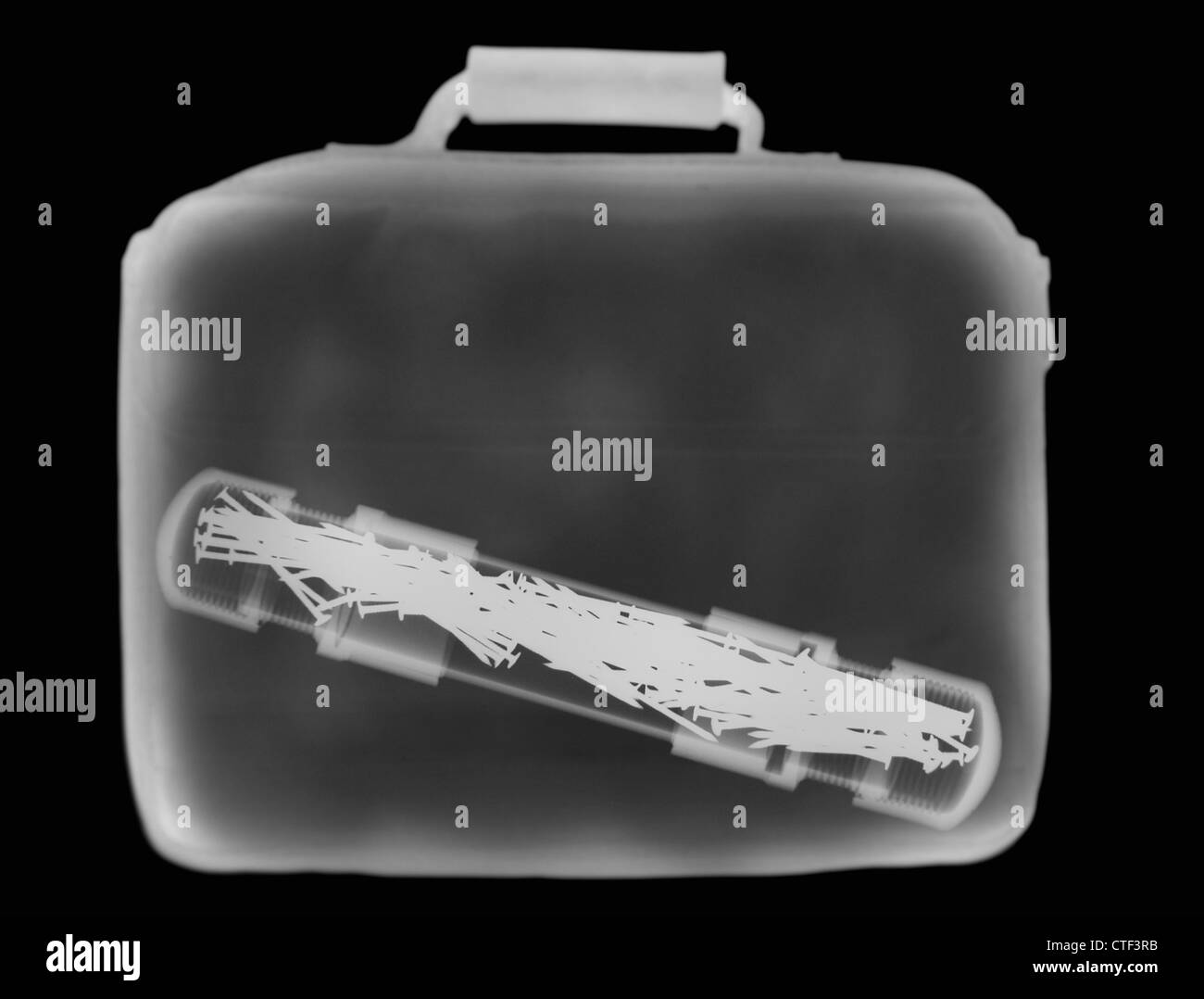 X ray image Black and White Stock Photos & Images - Alamy