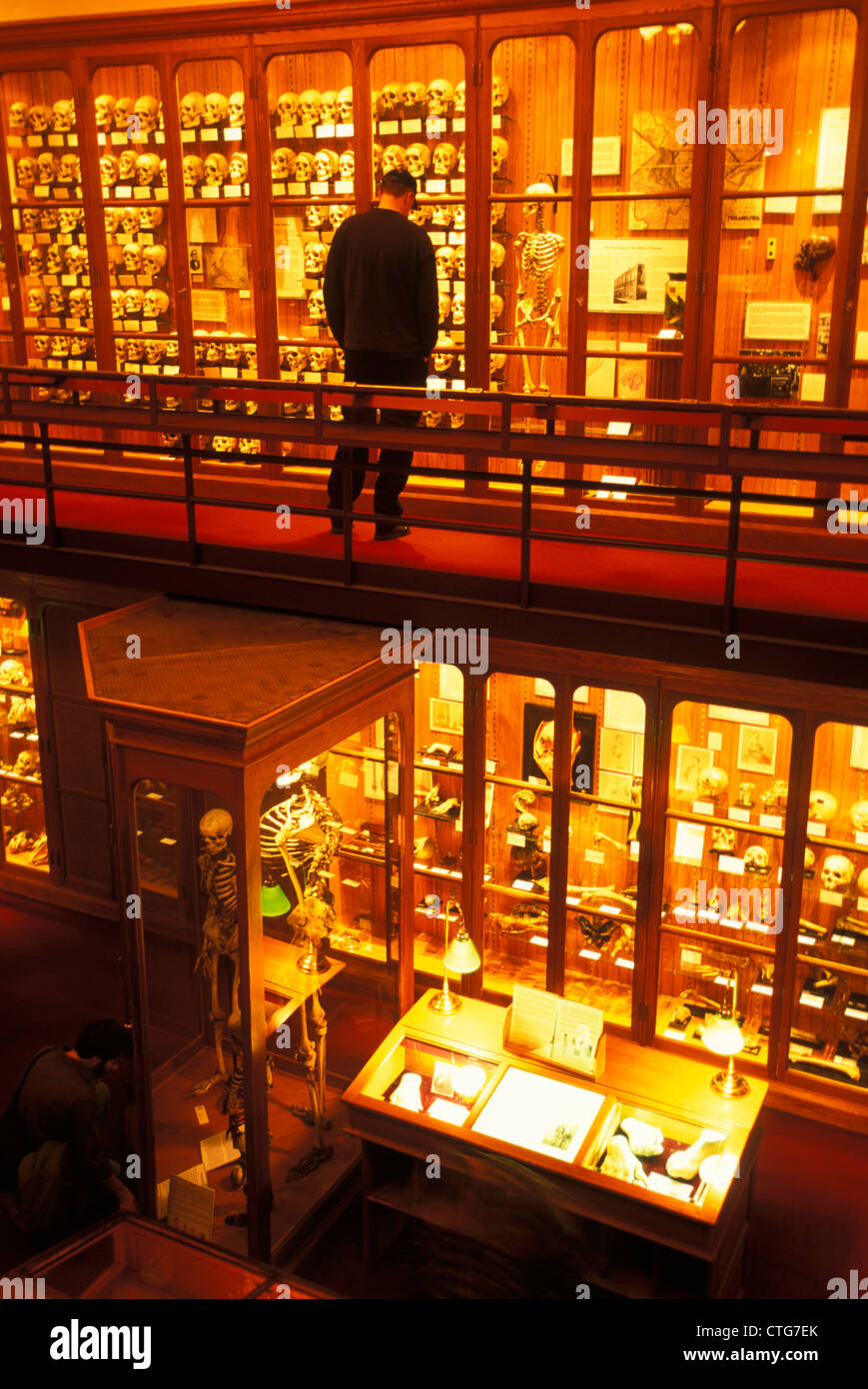 Mutter Museum Pimple