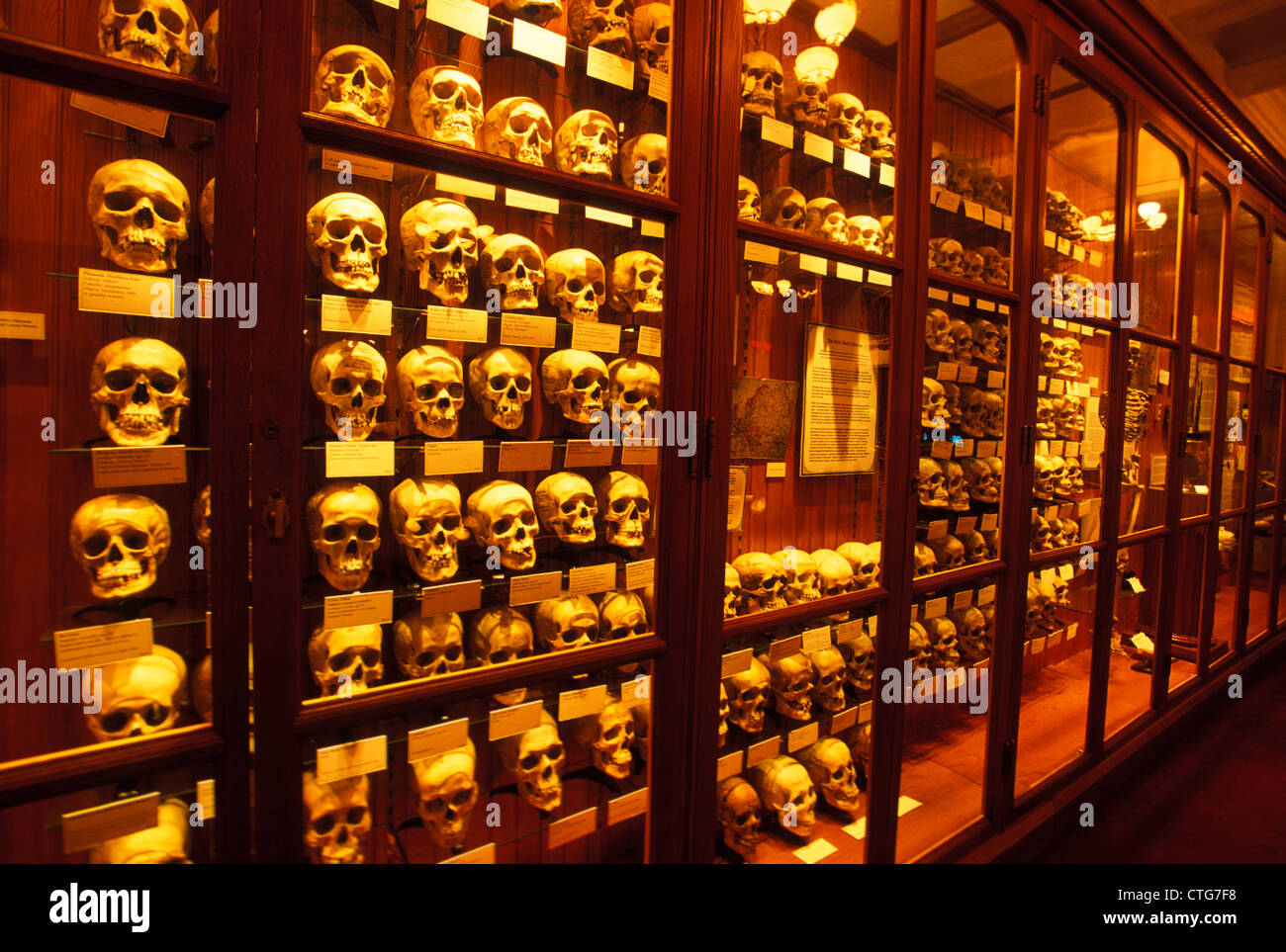 PHILADELPHIA PA COLLECTION OF HUMAN SKULLS ON DISPLAY AT THE MUTTER MUSEUM Stock Photo