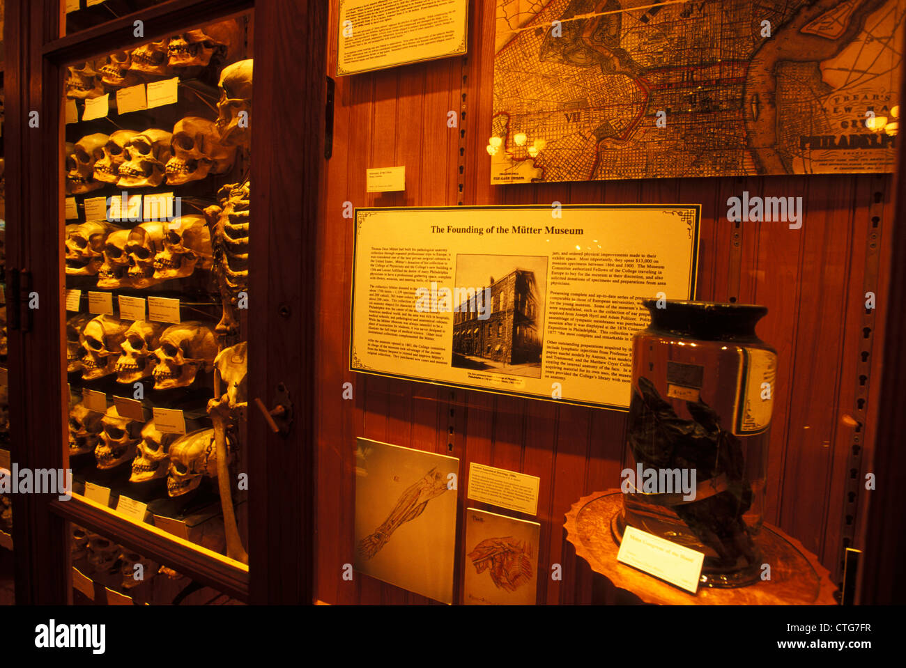 PHILADELPHIA PA COLLECTION OF HUMAN SKULLS ON DISPLAY AT THE MUTTER MUSEUM Stock Photo