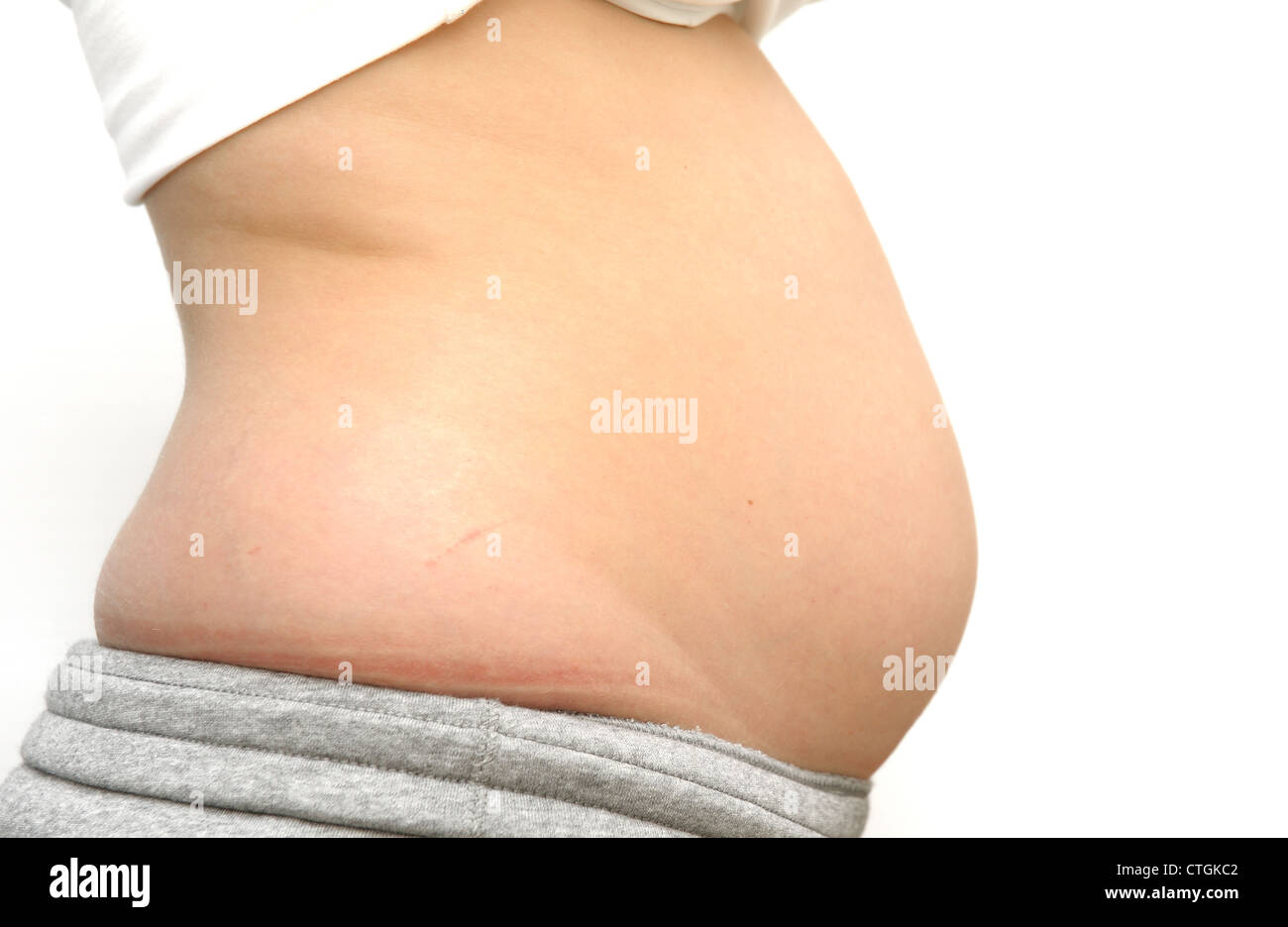 23 year old female 17 weeks pregnant Stock Photo