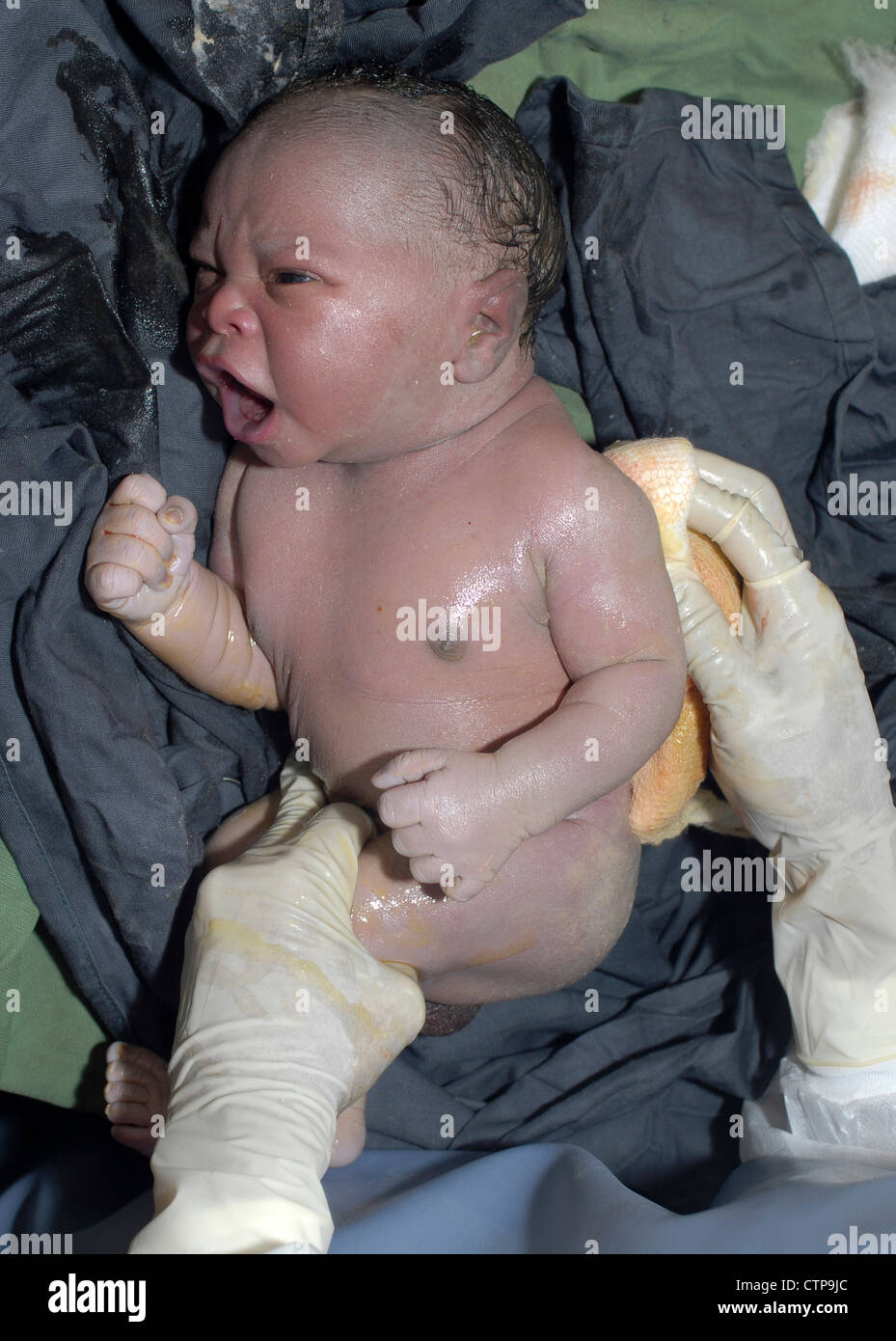 Infant delivered by Caesarean section. Stock Photo