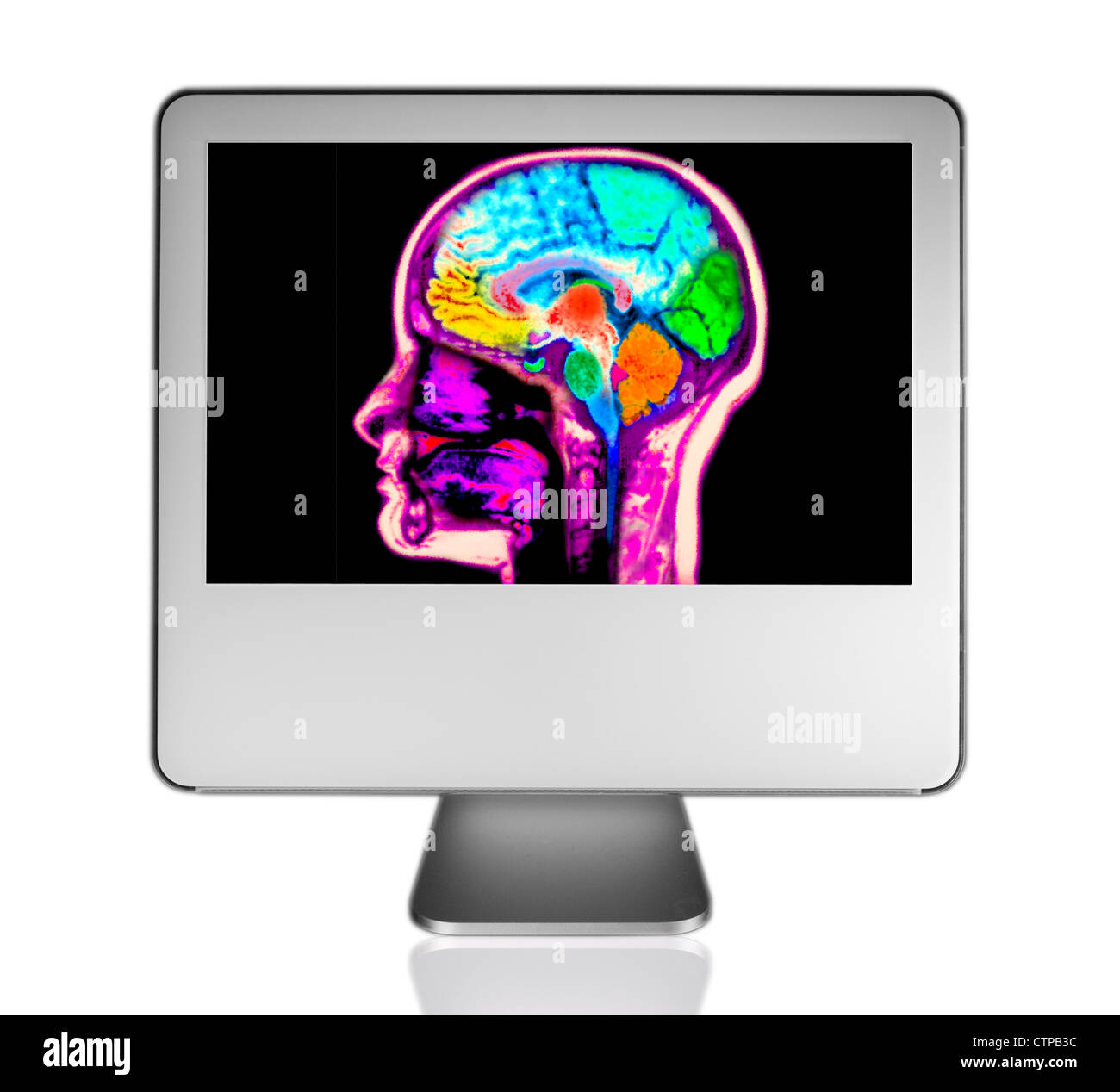 computer monitor showing an MRI scan of the brain Stock Photo