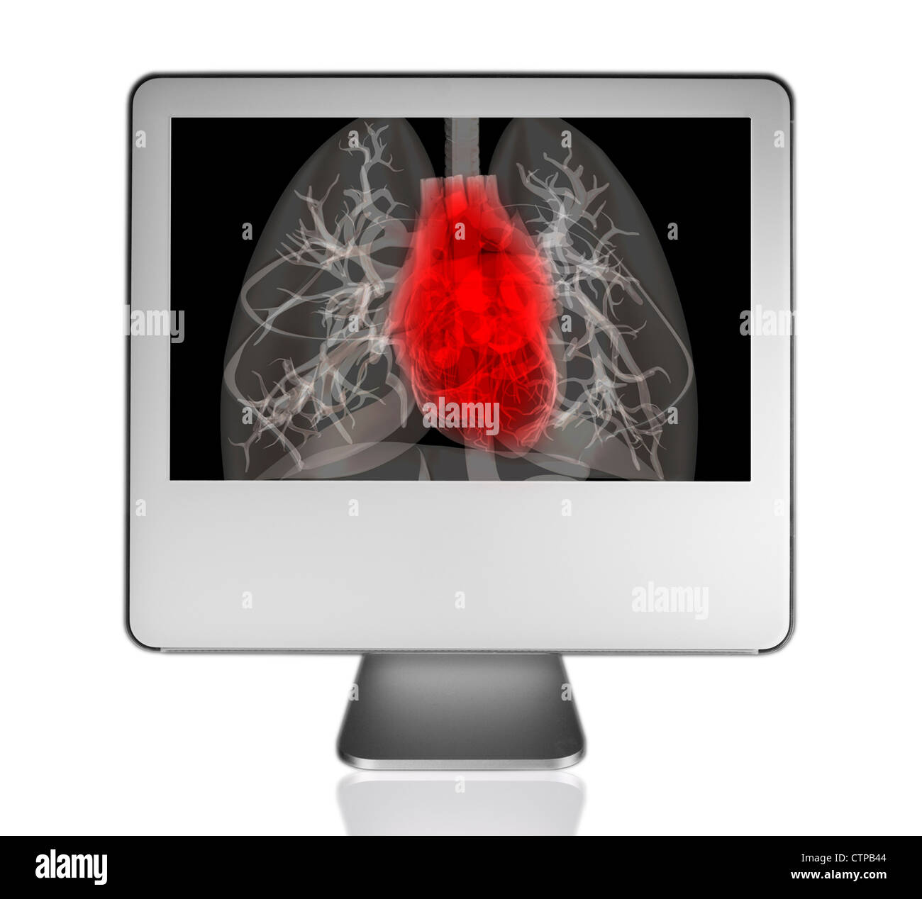 computer monitor showing the anatomy of the heart and lung Stock Photo