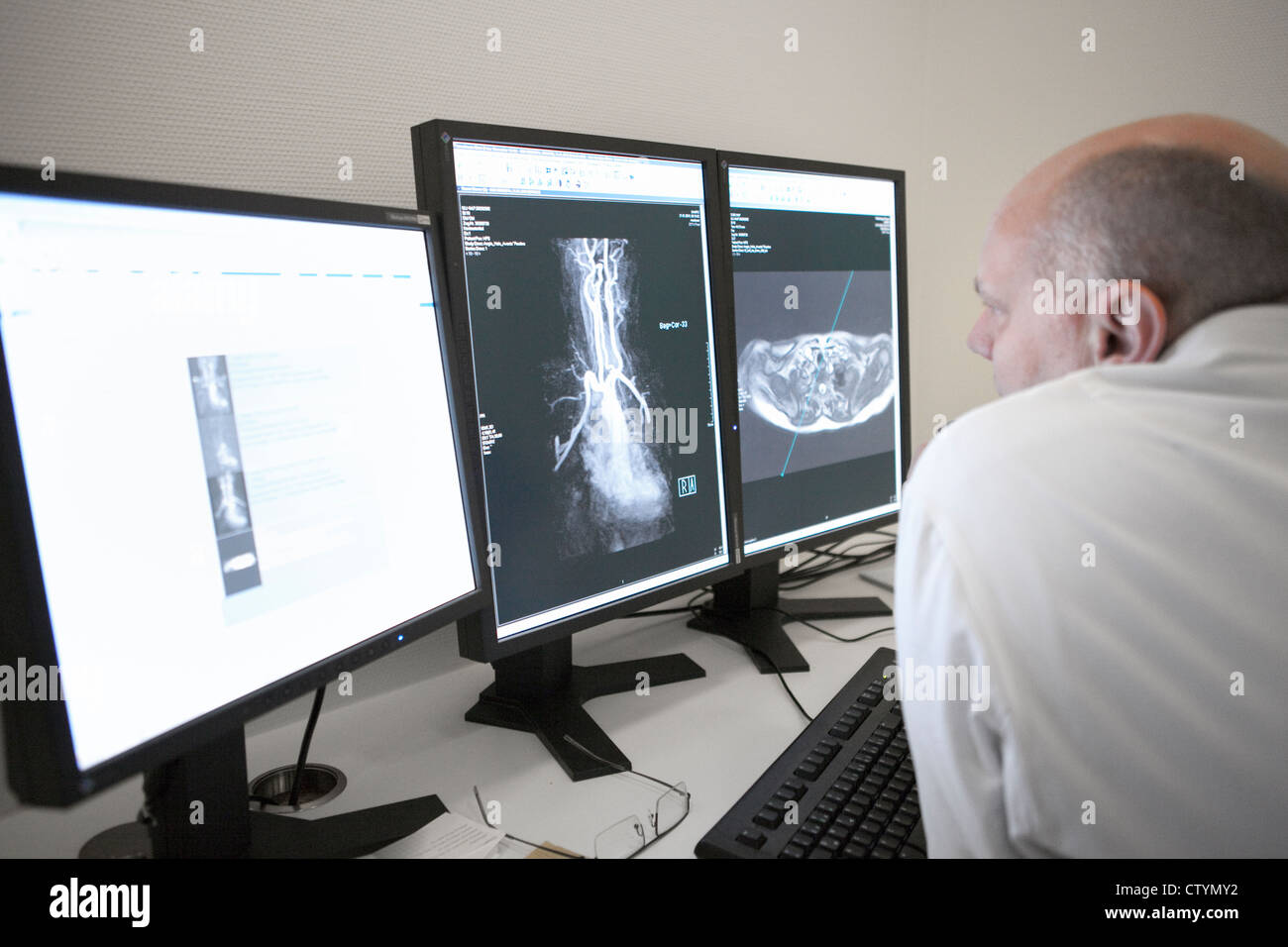 Radiologist examines MRI scan on monitor Stock Photo - Alamy