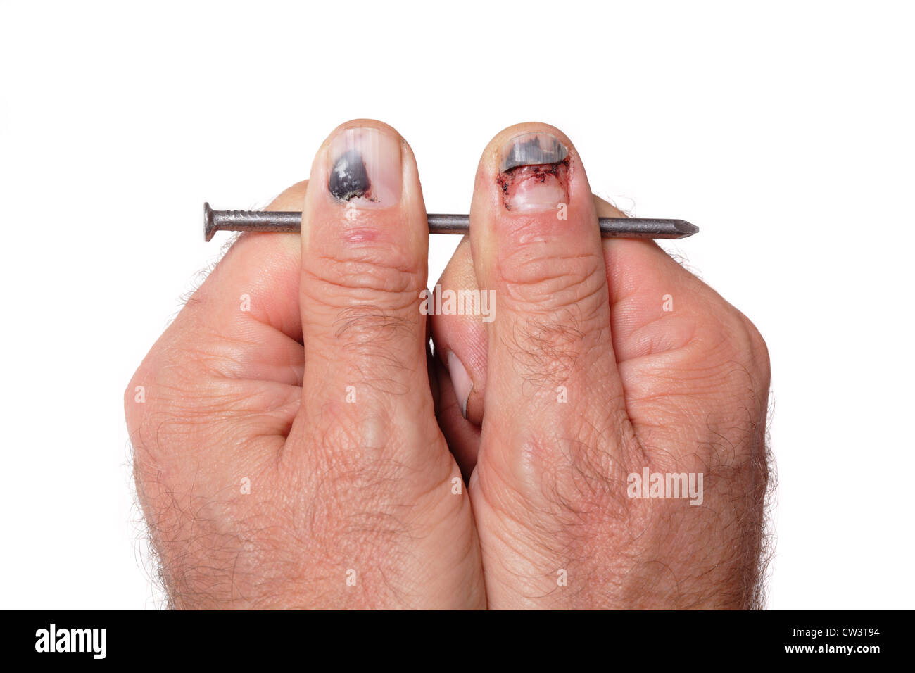 Nail Wound Stock Photos & Nail Wound Stock Images Alamy