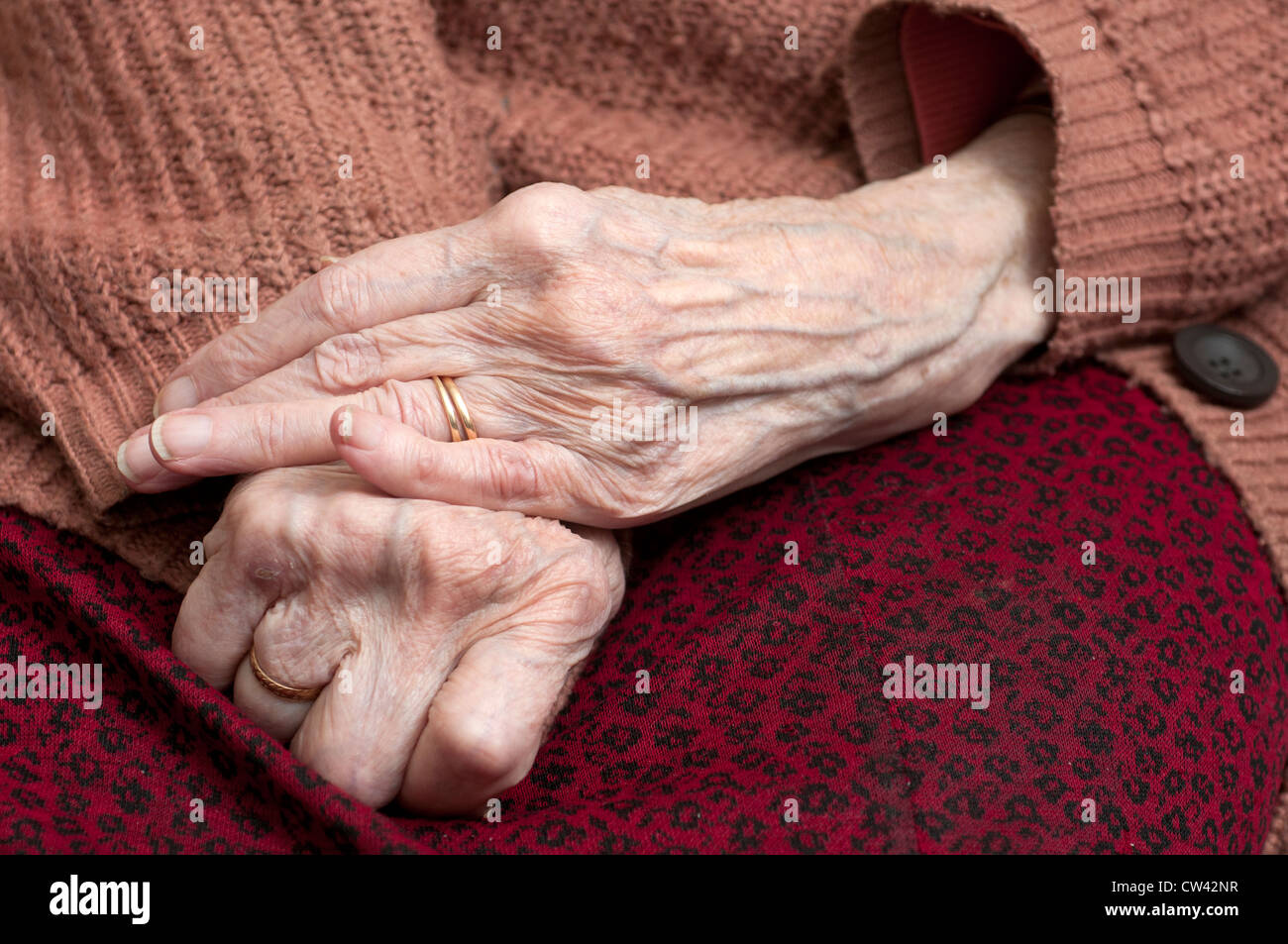 Arthritic hands of an elderly woman Stock Photo
