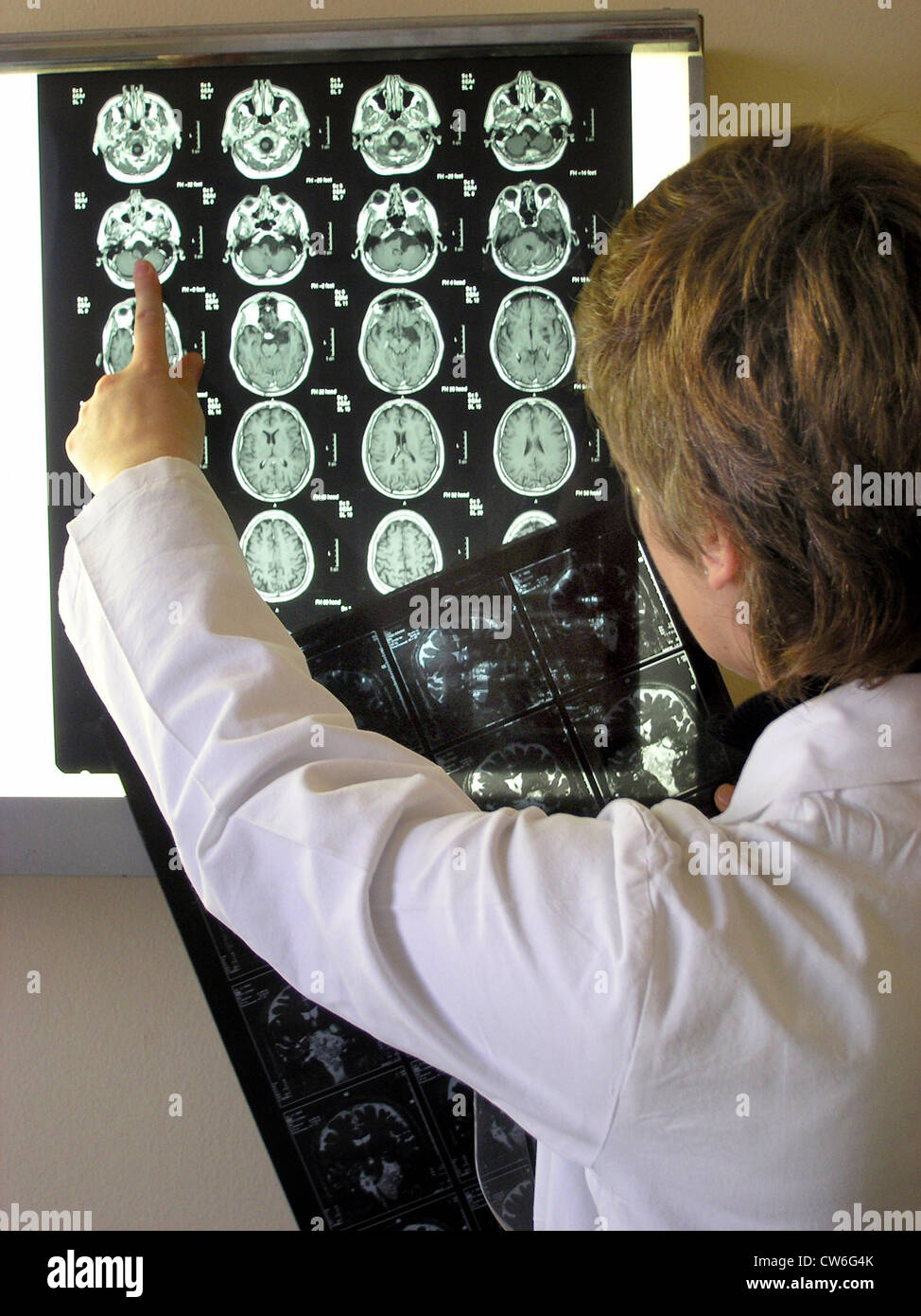 doctor with X-ray photograph of computer tomography Stock Photo - Alamy