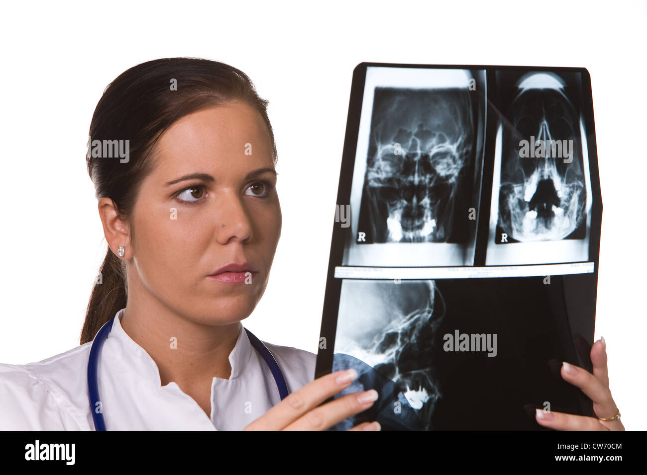 Doctor in the hospital with X-ray picture Stock Photo