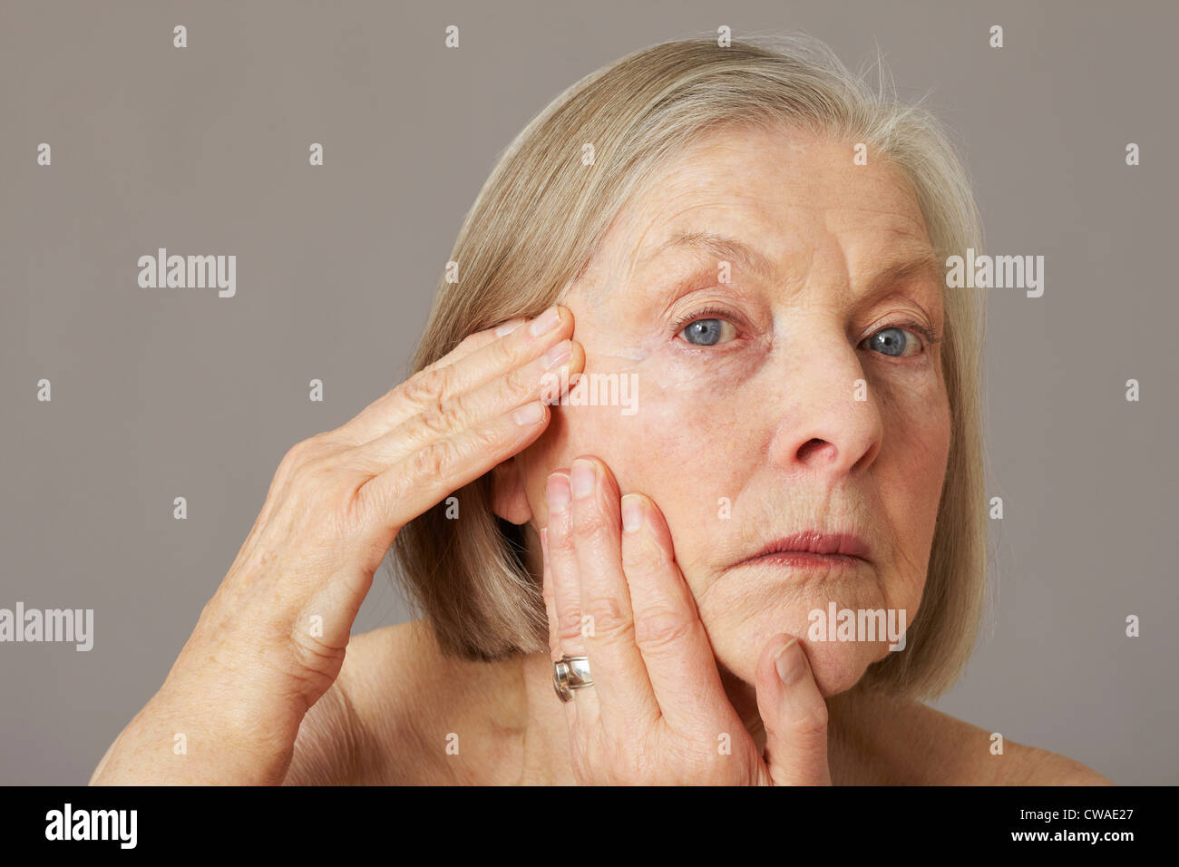 Почему отекает пожилой человек. Одутловатость лица у женщин после 60 лет. Отечность лица пожилой Возраст. Опухшие лицо у пожилых после инсульта.