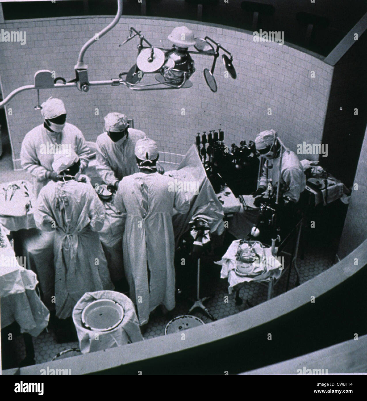 Heart surgery performed in the 1950s. Stock Photo