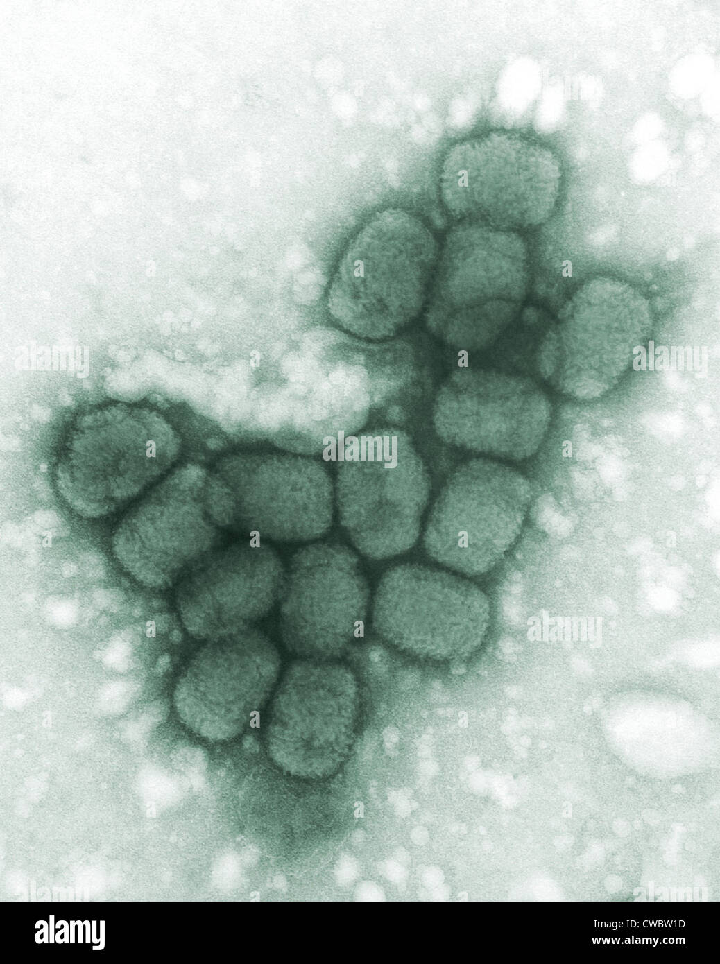Smallpox viruses. A colorized transmission electron micrograph. 1975. Stock Photo