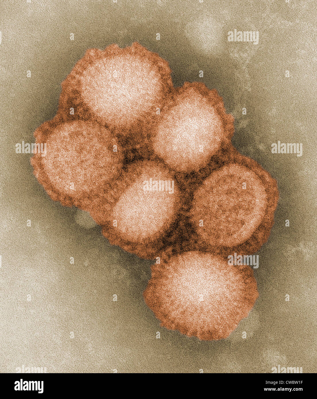 Swine flu virus. Colorized negative stained transmission electron micrograph. Photo by C. S. Goldsmith and A. Balish, 2009. Stock Photo