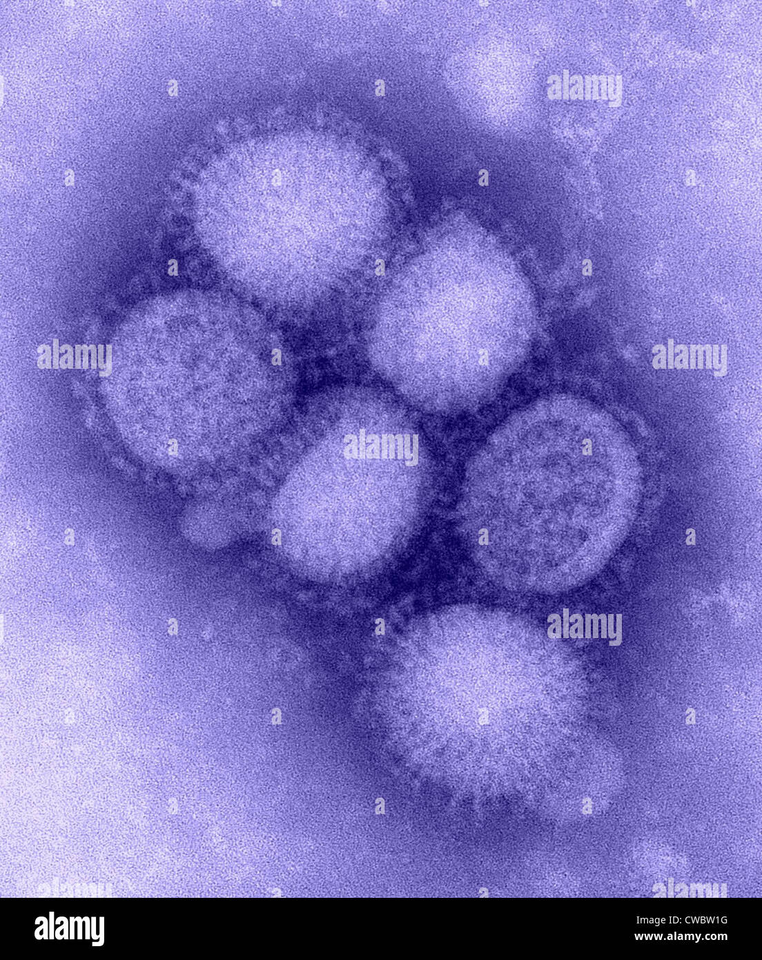 Swine flu virus. Negative stained transmission electron micrograph. Photo by C. S. Goldsmith and A. Balish, 2009. Stock Photo