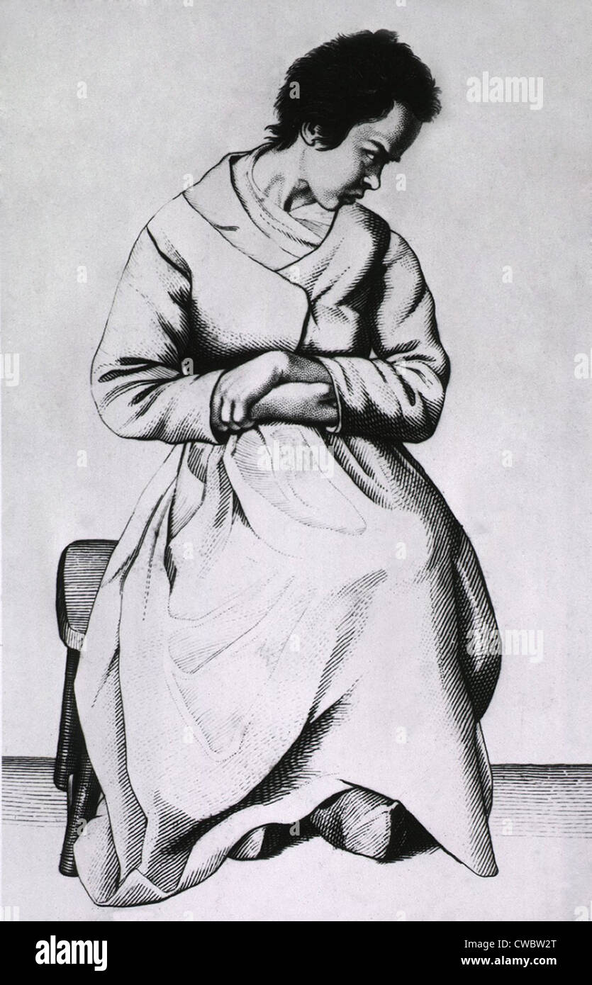 A woman with lypemania (melancholy or depression). From Etienne Esquirol's book describing the different types of mental Stock Photo