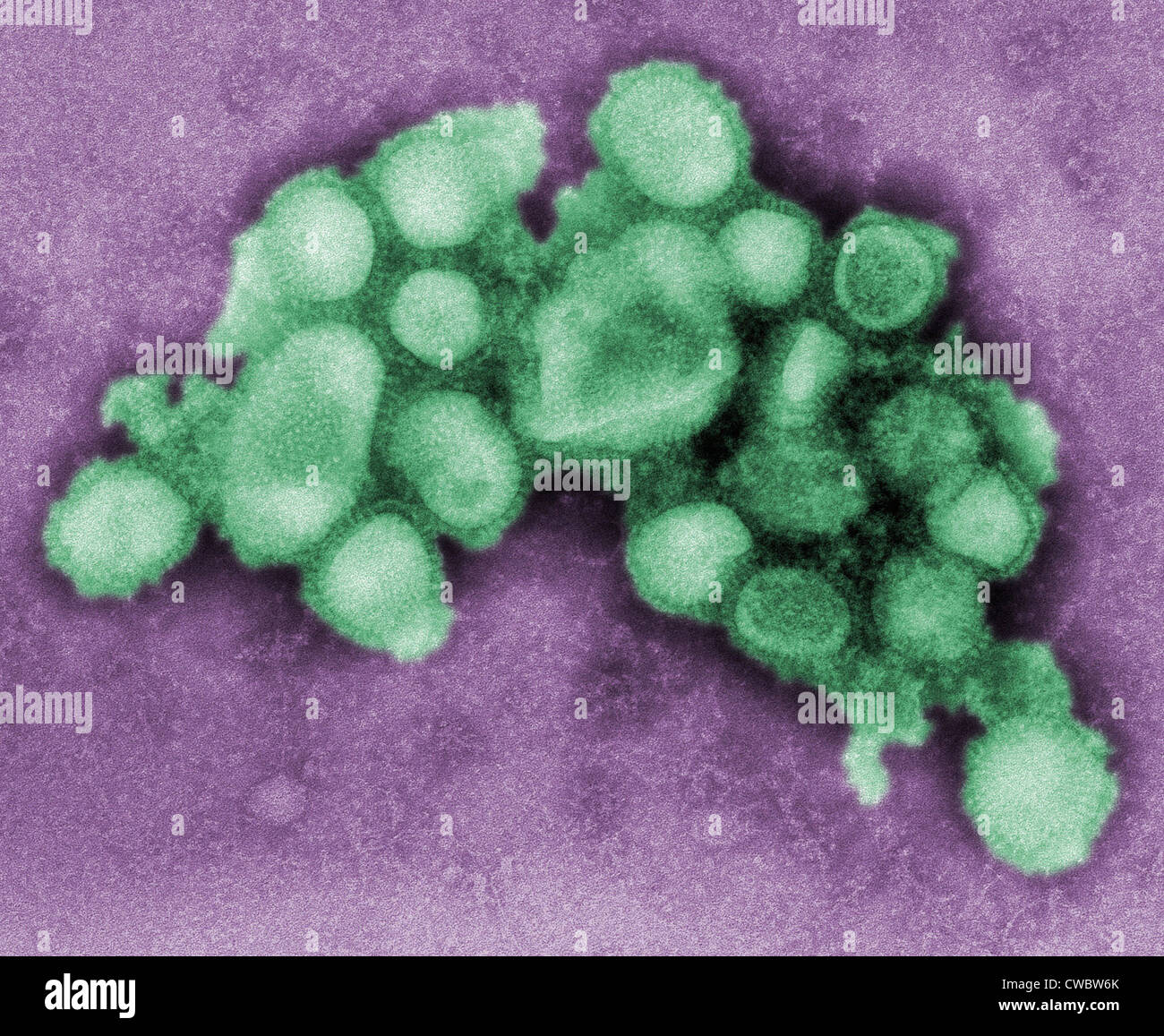 This colorized negative stained transmission electron micrograph of the A/CA/4/09 swine flu virus. 2009 photo by C. S. Stock Photo