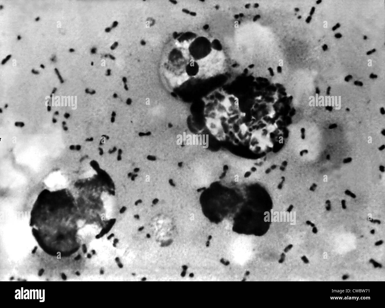 Yersinia pestis bacteria which caused Bubonic Plague. 1965 Stock Photo Alamy