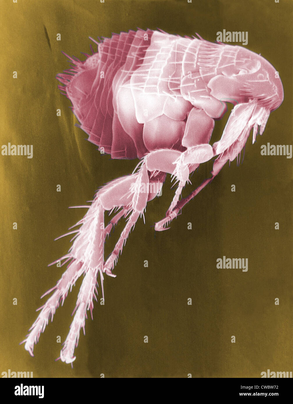 Scanning Electron Micrograph of a Flea. Fleas carry diseases including