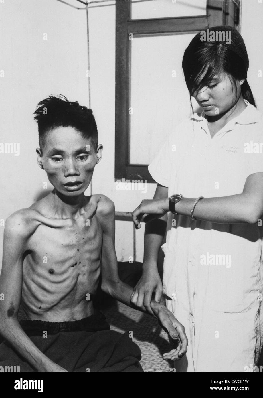 Victim of Viet Cong starvation. 23-year-old former Viet Cong defector to South Viet Nam, was deliberately starved when Stock Photo