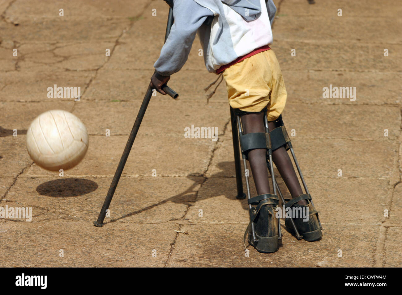 Football crutch polio hires stock photography and images Alamy