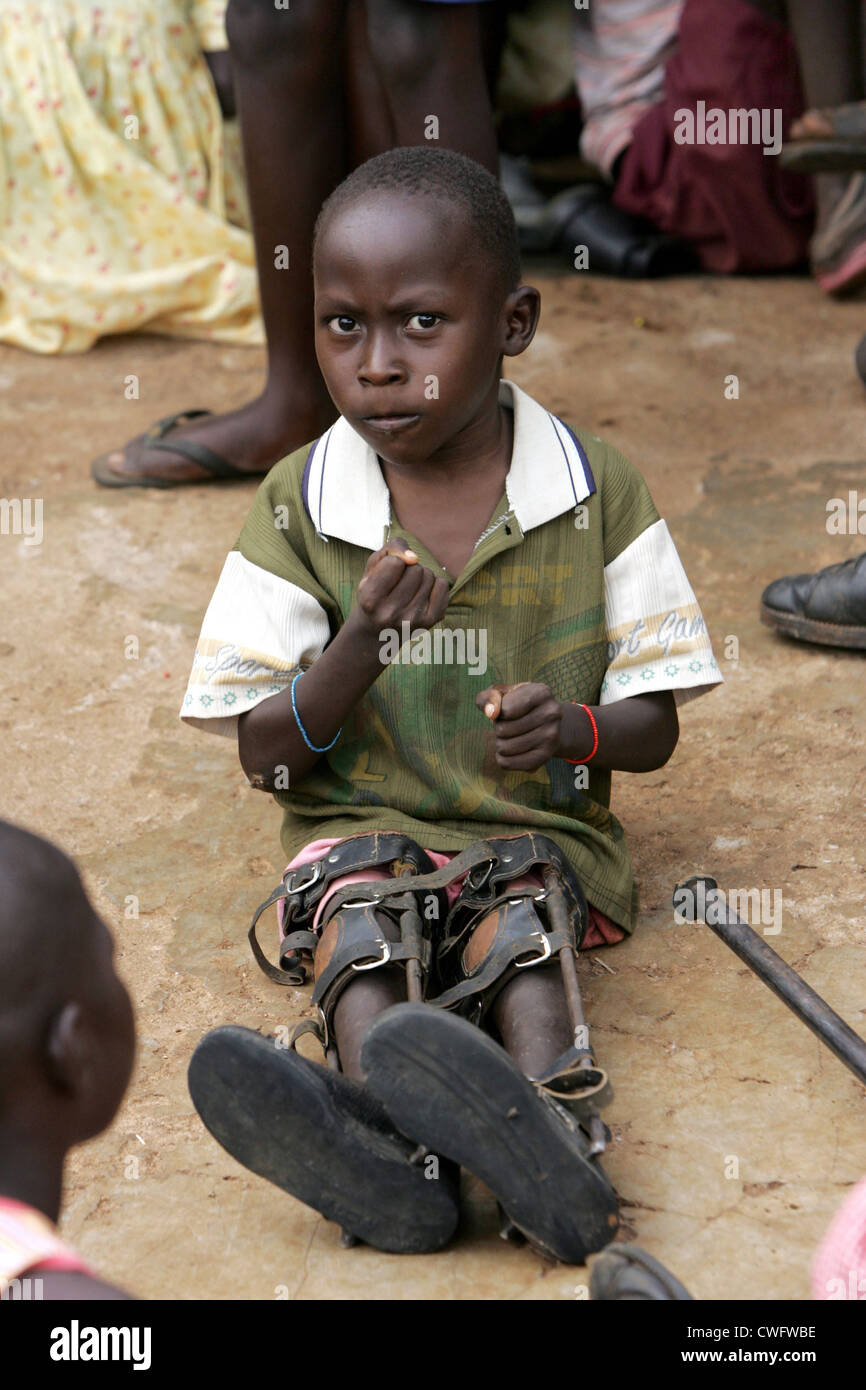 Kenya, handicapped.All live in the mission Nyabondo Stock Photo