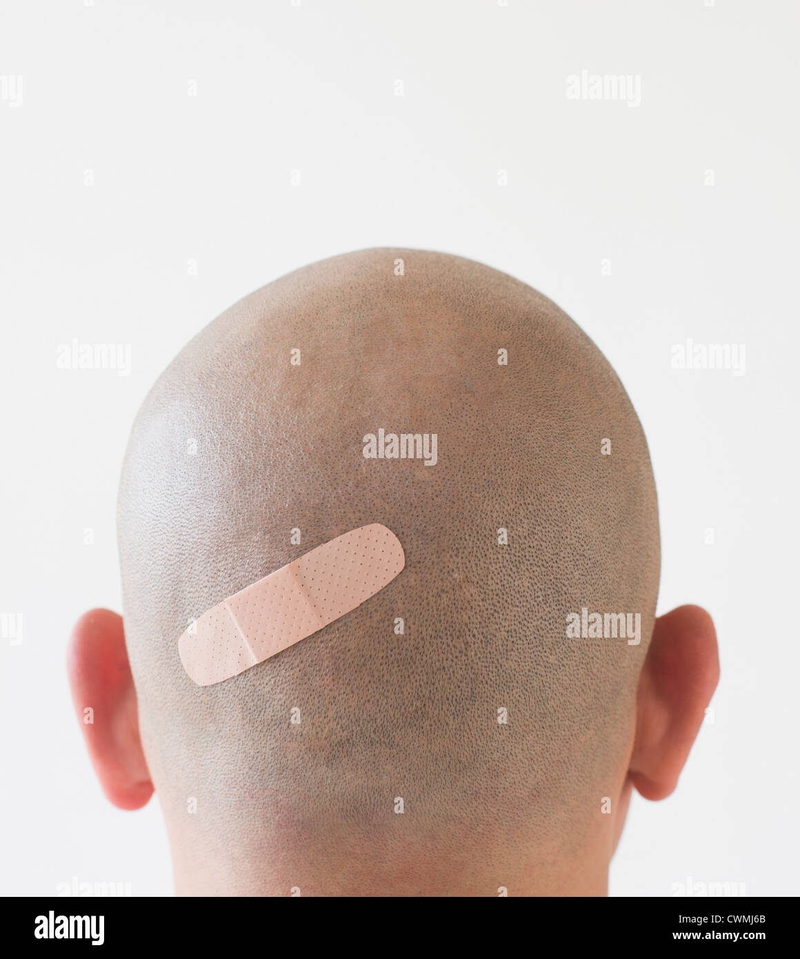 Back view of man with adhesive bandage on shaved head Stock Photo Alamy