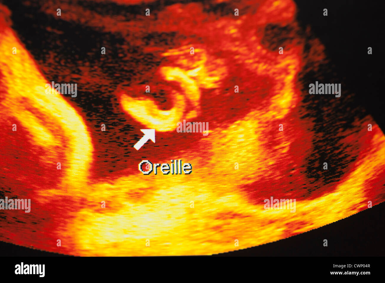 Ultrasound scan of developing fetus Stock Photo